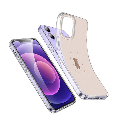 Teddy 🧸💕 Phone Case